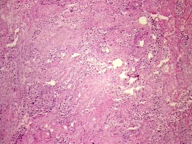 Tissue Total RNA, Urinary bladder - image 1