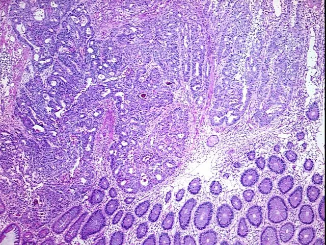 Tissue Total RNA, Colon - image 1
