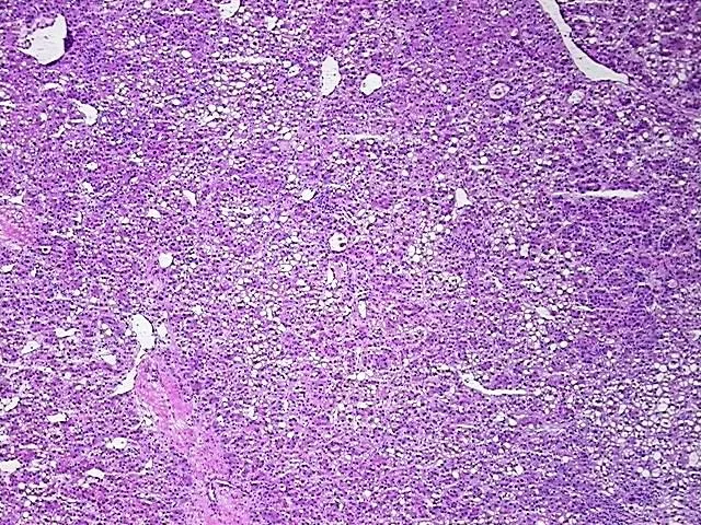 Tissue Total RNA, Liver: left lobe - image 1
