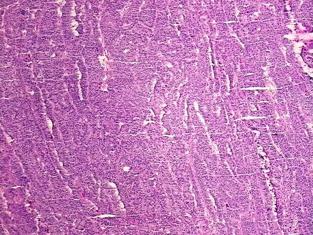 Tissue Total RNA, Ovary: right - image 1