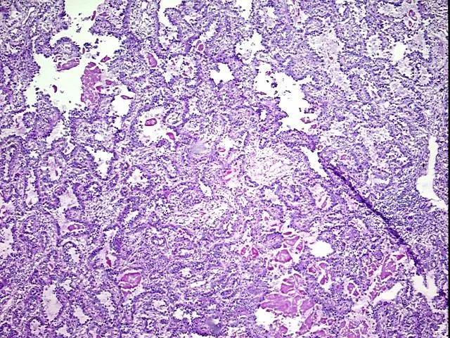 Tissue Total RNA, Lung - image 1