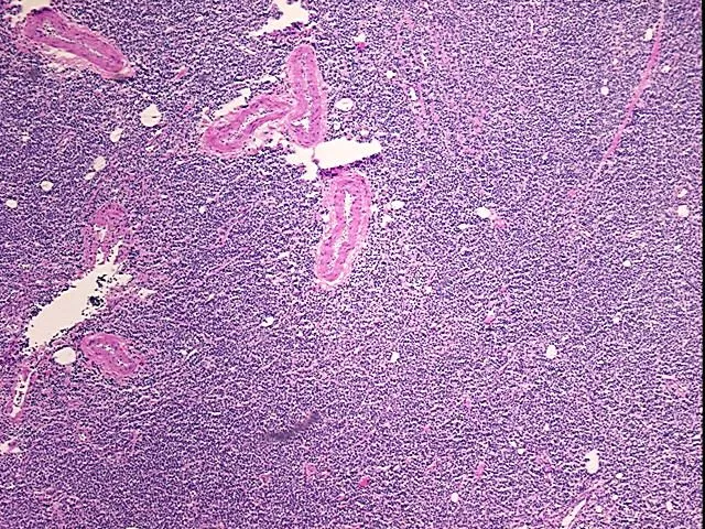 Tissue Total RNA, Lymphoid tissue - image 1