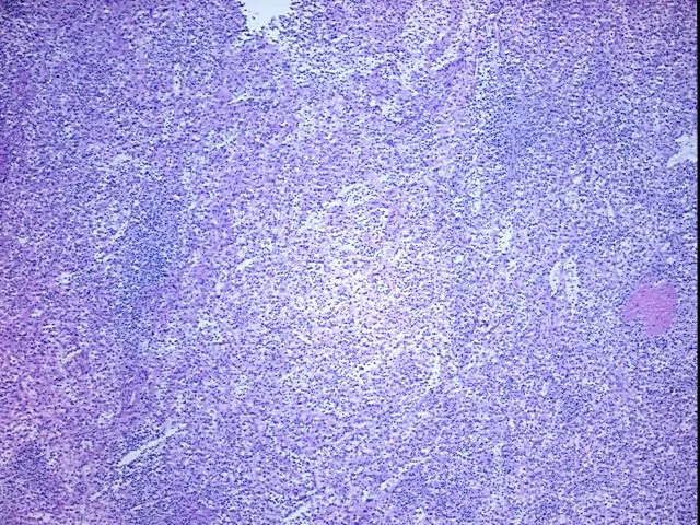 Tissue Total RNA, Lymphoid tissue - image 1