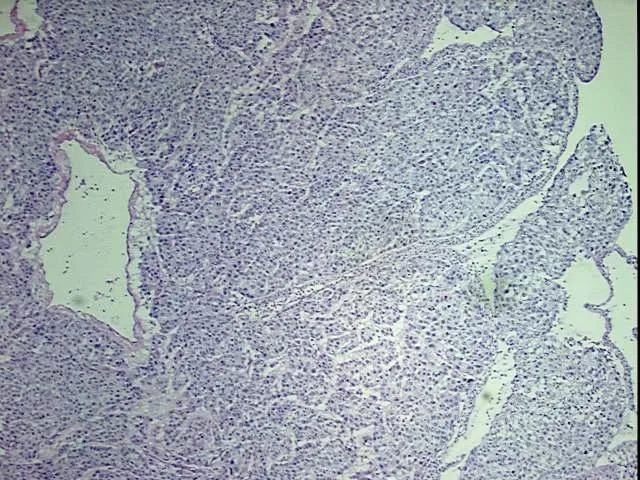 Tissue Total RNA, Urinary bladder - image 1