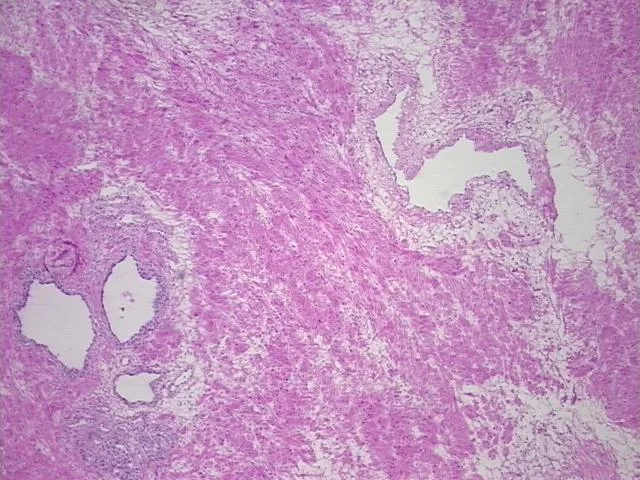 Frozen Tissue Sections, Prostate - image 1