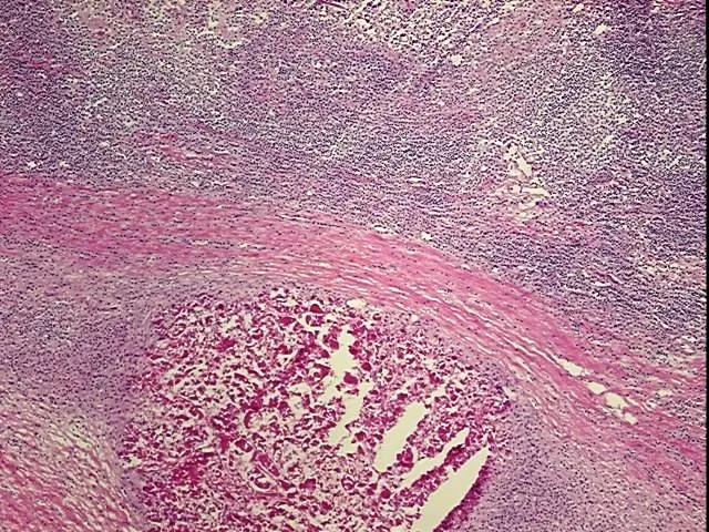 Frozen Tissue Sections, Skin - image 1