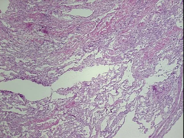 Frozen Tissue Sections, Lung - image 1