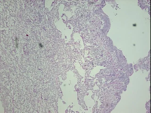 Frozen Tissue Sections, Lung - image 1