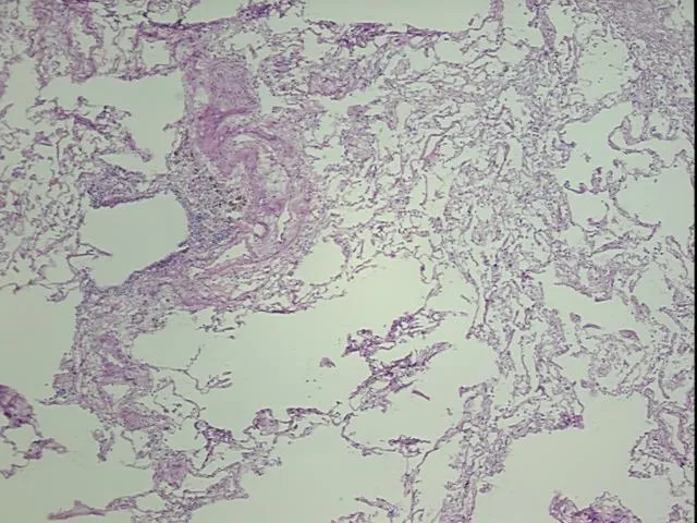 Frozen Tissue Sections, Lung - image 1