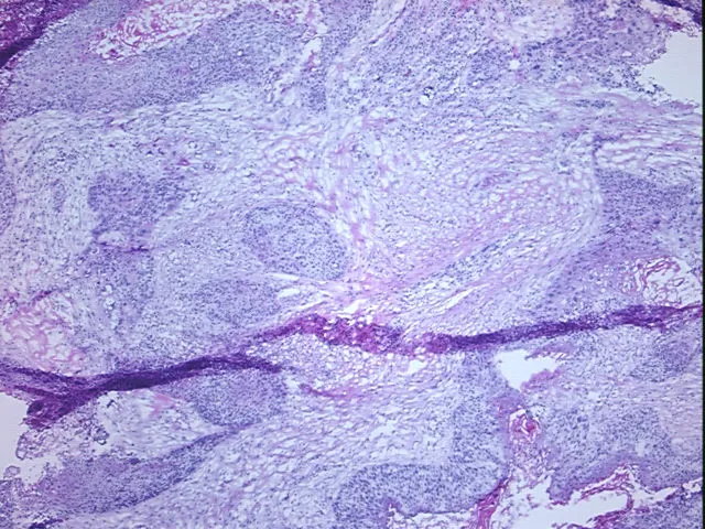 Frozen Tissue Sections, Neck - image 1