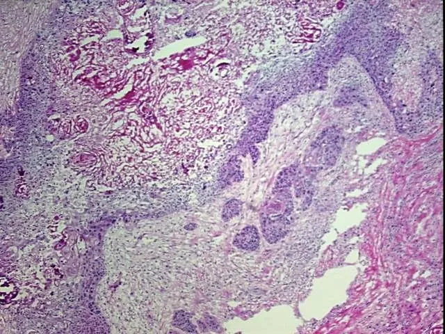 Frozen Tissue Sections, Neck - image 1