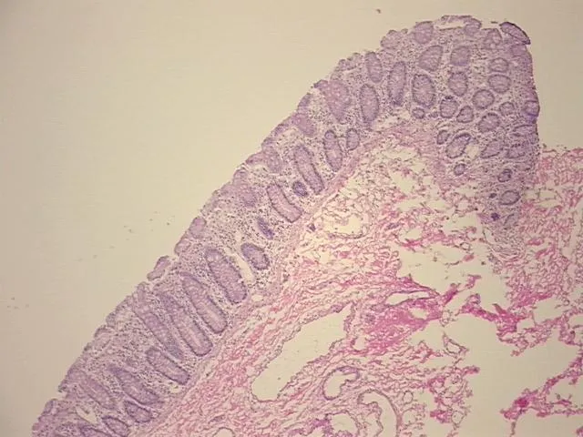 Frozen Tissue Sections, Colon - image 1