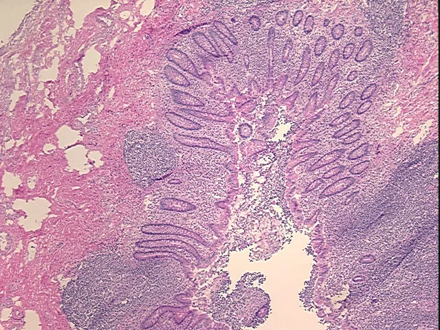 Frozen Tissue Sections, Appendix - image 1