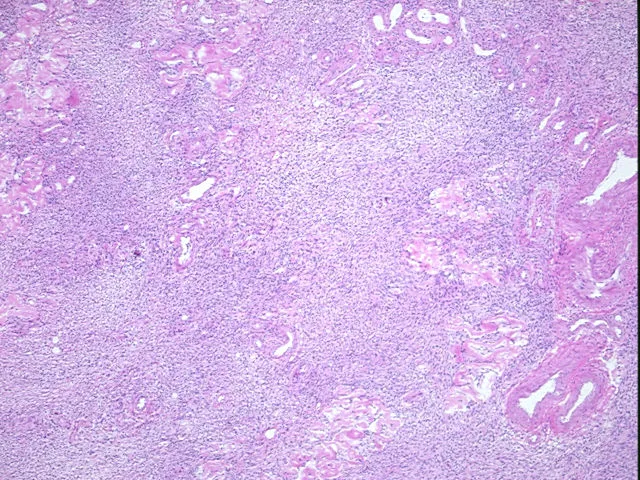 Frozen Tissue Sections, Ovary - image 1