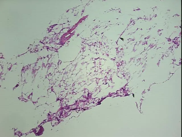 Frozen Tissue Sections, Kidney - image 1