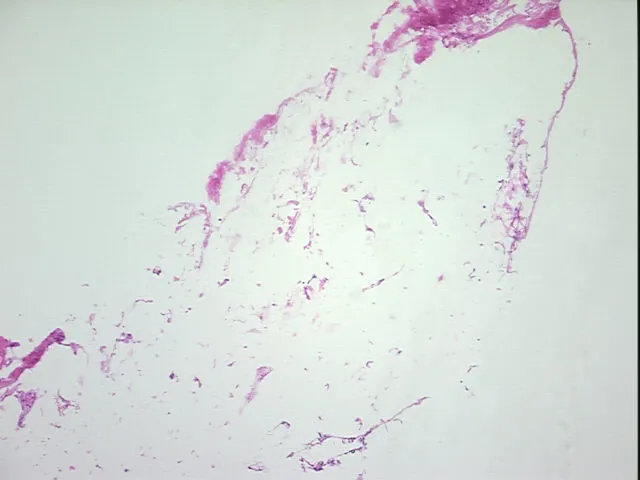 Frozen Tissue Sections, Adipose tissue - image 1