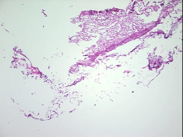 Frozen Tissue Sections, Adipose tissue - image 1