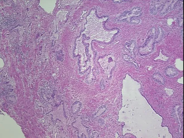 Frozen Tissue Sections, Prostate - image 1