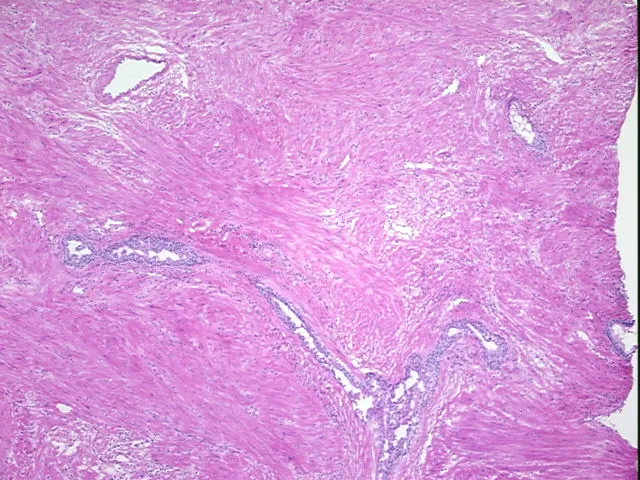 Frozen Tissue Sections, Prostate - image 1