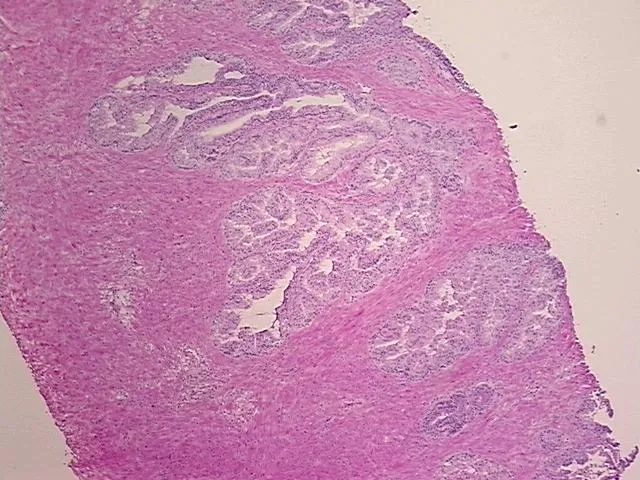 Frozen Tissue Sections, Prostate - image 1