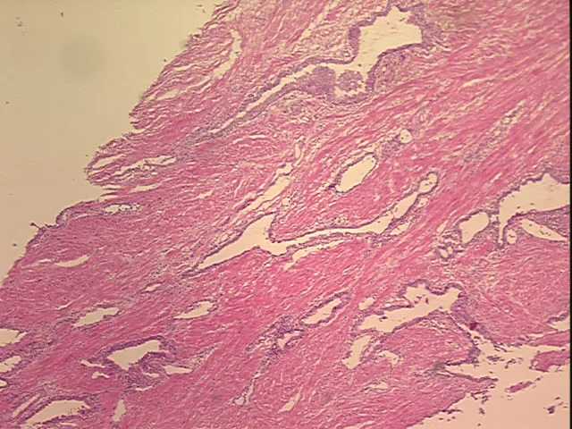Frozen Tissue Sections, Prostate - image 1