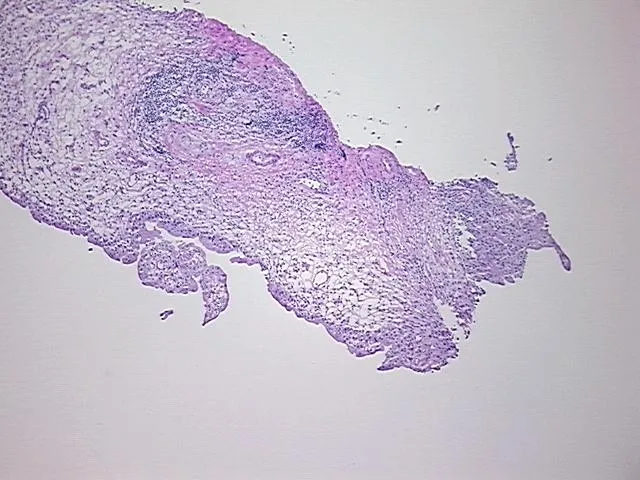 Frozen Tissue Sections, Urinary bladder - image 1