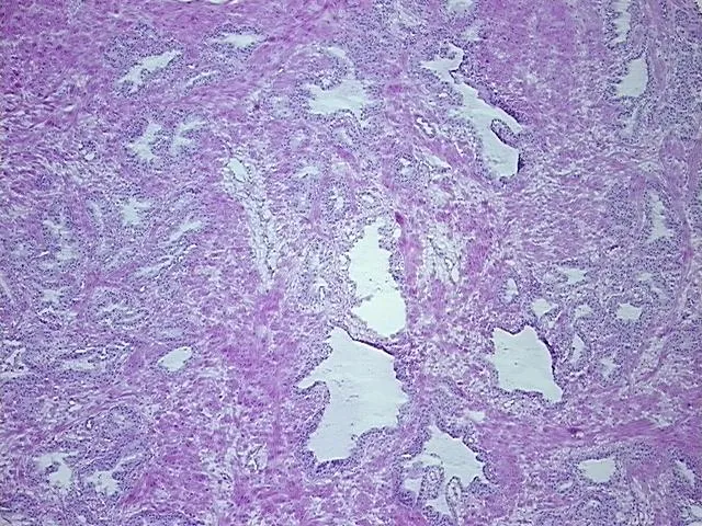 Frozen Tissue Sections, Prostate - image 1