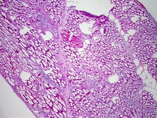 Frozen Tissue Sections, Muscle tissue - image 1