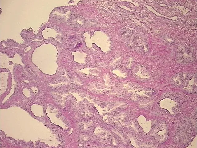 Frozen Tissue Sections, Prostate - image 1