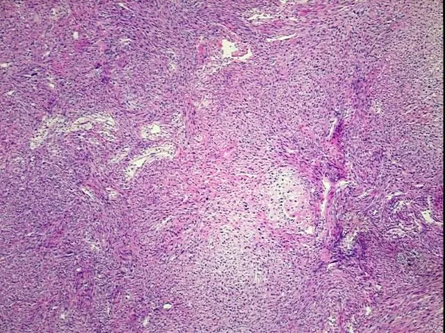 Frozen Tissue Sections, Bone - image 1