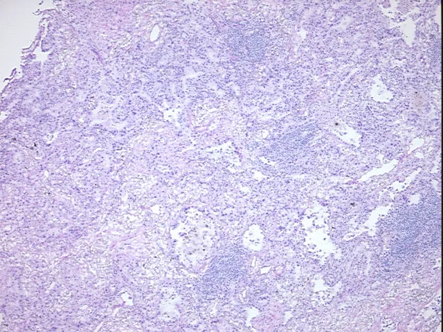 Tissue FFPE Sections, Lung - image 1