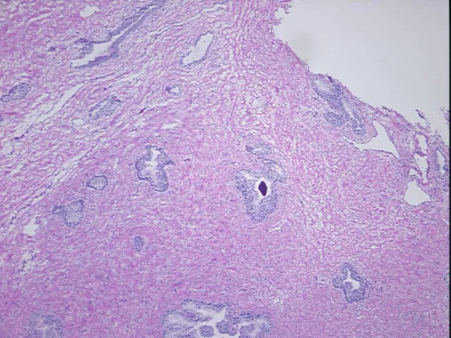 Frozen Tissue Sections, Prostate - image 1