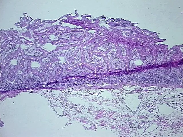 Frozen Tissue Sections, Duodenum - image 1