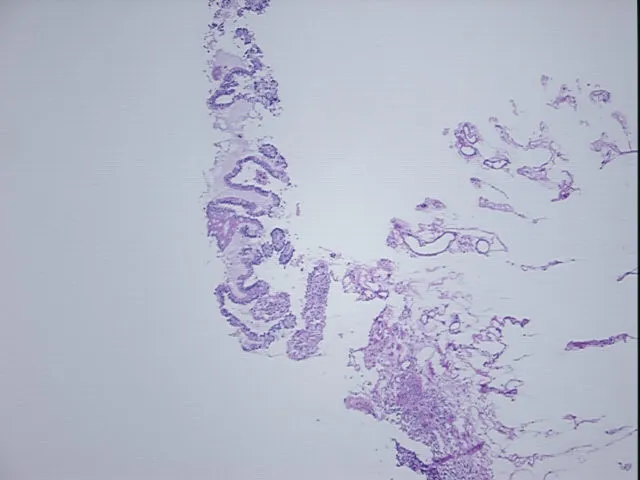 Frozen Tissue Sections, Ileum - image 1