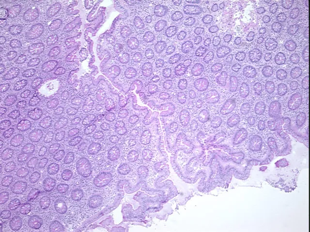 Frozen Tissue Sections, Colon - image 1