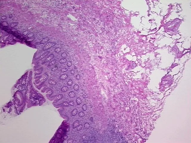 Frozen Tissue Sections, Appendix - image 1