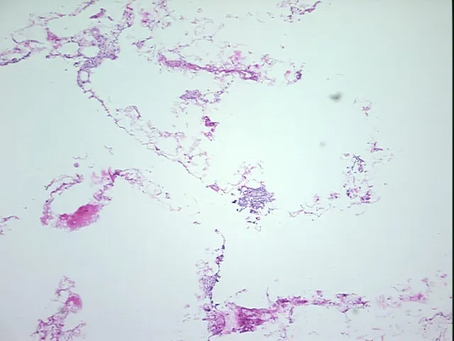 Frozen Tissue Sections, Thymus - image 1