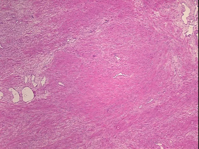 Frozen Tissue Sections, Prostate - image 1