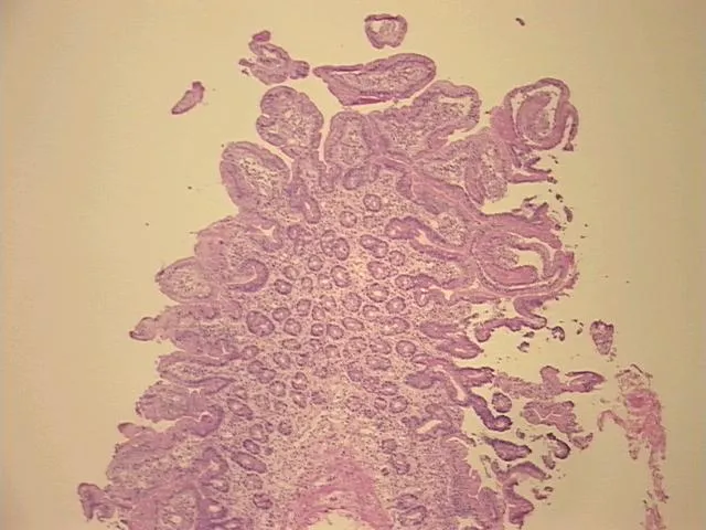 Frozen Tissue Sections, Duodenum - image 1