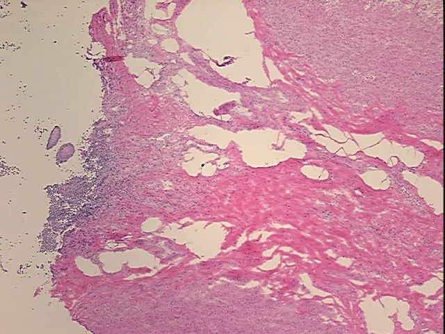 Frozen Tissue Sections, Appendix - image 1