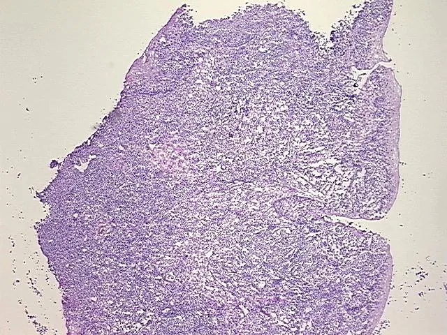 Frozen Tissue Sections, Larynx - image 1
