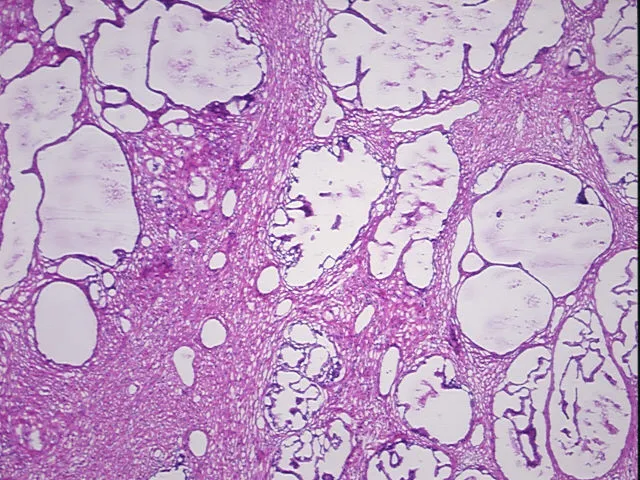 Frozen Tissue Sections, Prostate - image 1