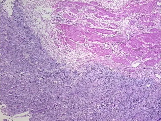 Frozen Tissue Sections, Ureter - image 1