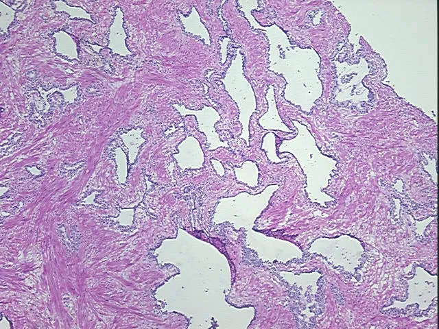 Frozen Tissue Sections, Prostate - image 1