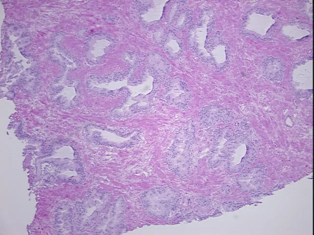 Frozen Tissue Sections, Prostate - image 1