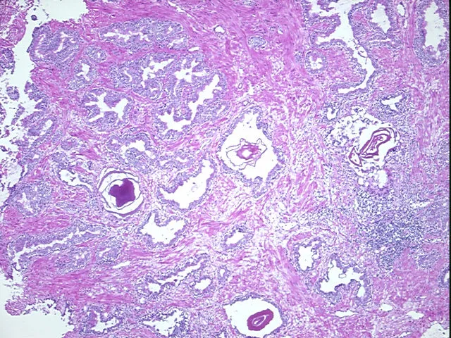 Frozen Tissue Sections, Prostate - image 1