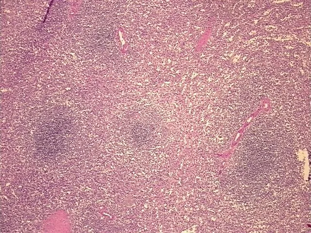 Frozen Tissue Sections, Spleen - image 1