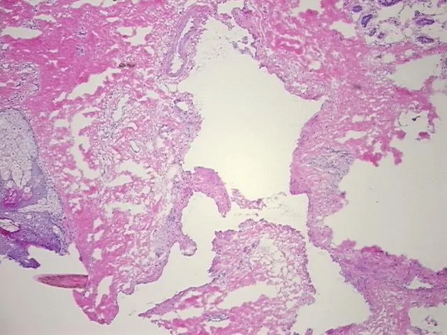 Frozen Tissue Sections, Penis - image 1