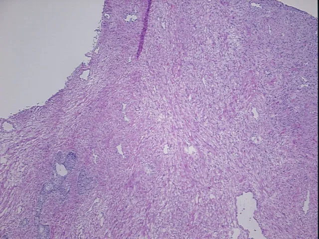 Frozen Tissue Sections, Prostate - image 1