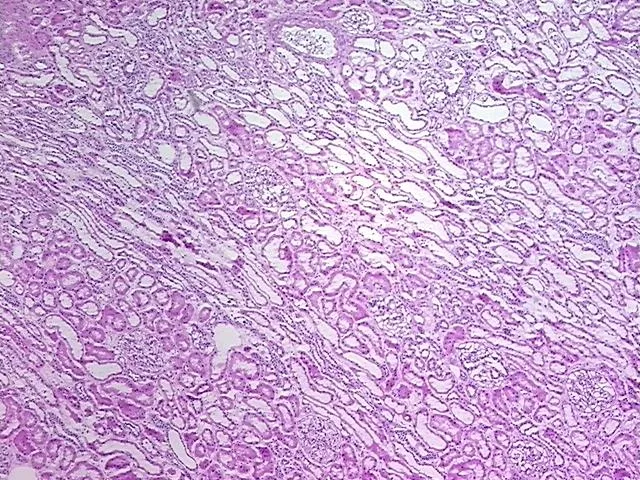 Frozen Tissue Sections, Kidney - image 1